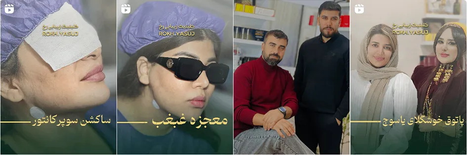 نمونه کار یکی از بهترین مراکز زیبایی در یاسوج را مشاهده میفرمایید.