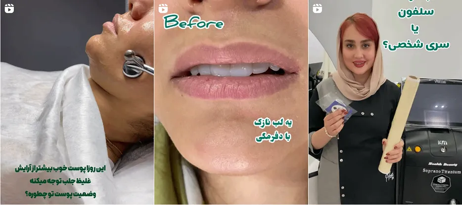 نمونه کار کلینیک رویال از جمله بهترین کلینیک زیبایی در سنندج است