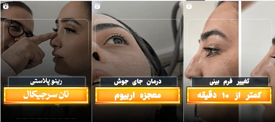 نمونه کار یکی از بهترین کلینیک زیبایی در تهران را در این تصویر میتوانید مشاهده بفرمایید