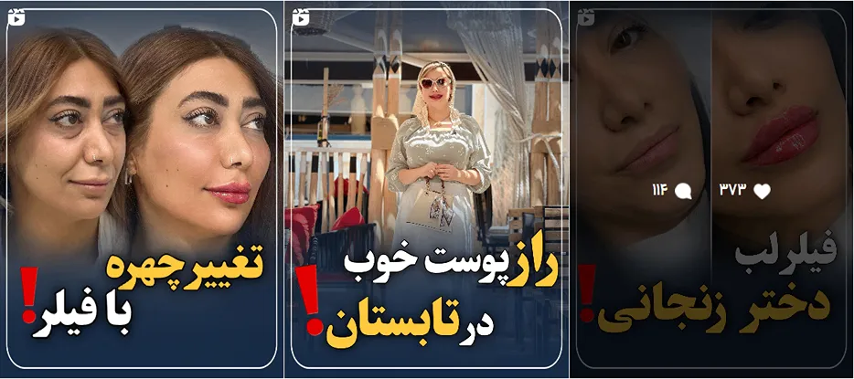 نمونه کار دکتر نباتچی را در این تصویر میتوانید مشاهده بفرمایید.