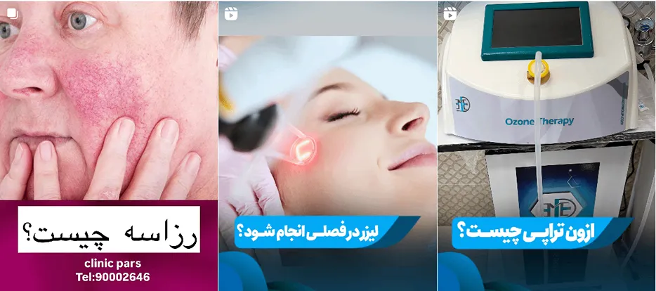 نمونه کار دکت صمدی را در این تصویر میتوانید مشاهده بفرمایید.