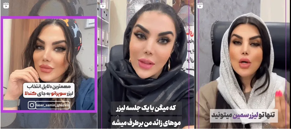 لیزر قزوین در کلینیک زیبایی سمین کاملا قابل انجام است