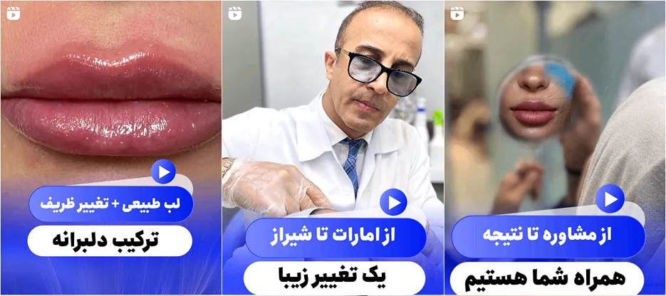 لیزر شییراز در کلینیک سیب کاملا قابل انجام است