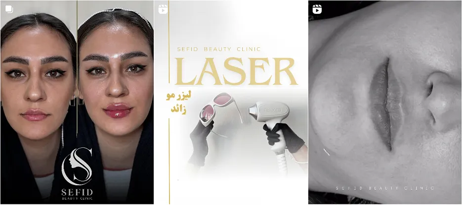 نمونه کار کلینیک سفید را در این تصویر میتوانید مشاهده بفرمایید.