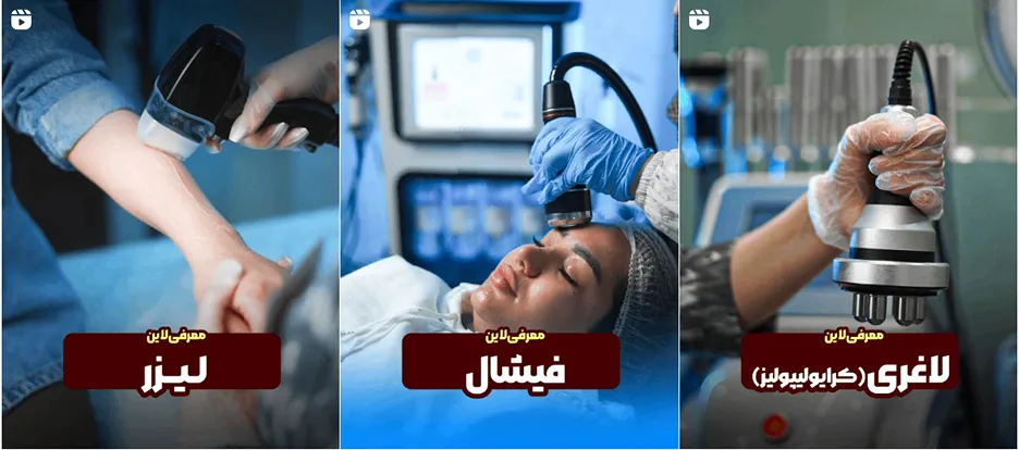 نمونه کار یکی از بهترین کلینیک لیزر در همدان را مشاهده میفرمایید.