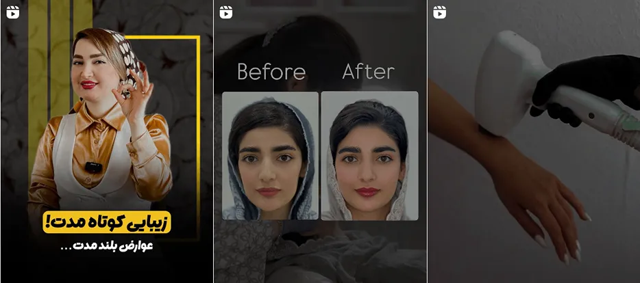 نمونه کار یکی دیگر از مدرنترین کلینیک زیبایی بندرعباس را در اینجا مشاهده میفرمایید.