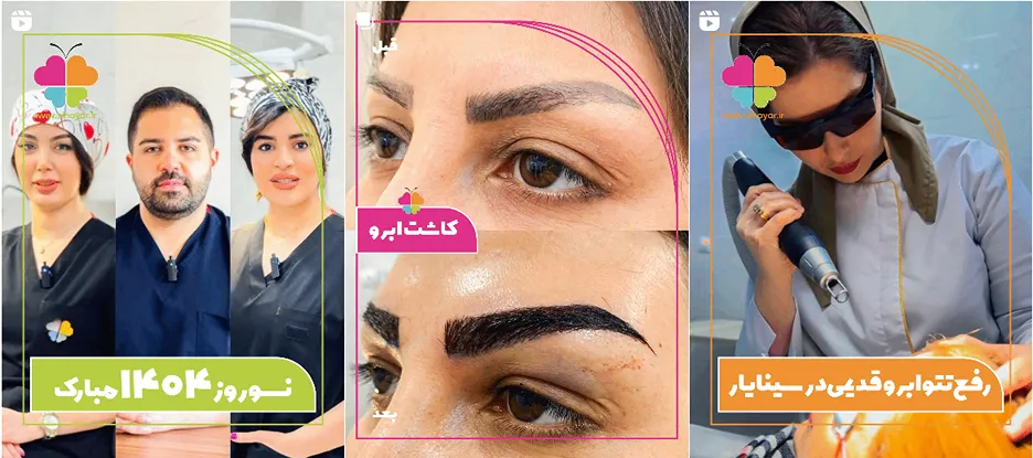 لیزر در اصفهان در کلینیک سینایار کاملا قابل انجام است