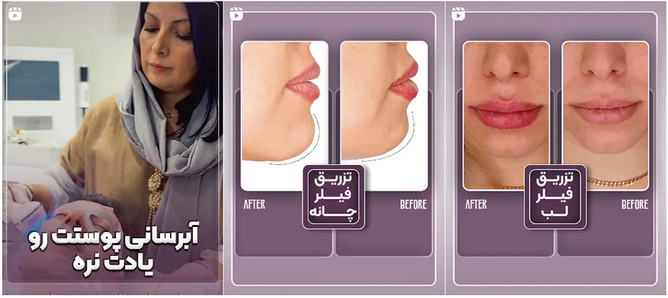 نمونه کار کلینیک زیبایی سیتا را در این تصویر میتوانید مشاهده بفرمایید: