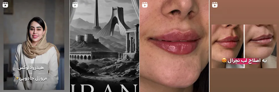 نمونه کار یکی از بهترین کلینیک زیبایی در خرم آباد را مشاهده میفرمایید.