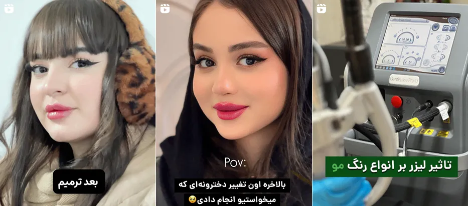 لیزر در اردبیل در کلینیک دکتر طلوعی کاملا قابل انجام است