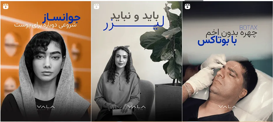 نمونه کار یکی از بهترین مرکز لیزر در کرمان را مشاهده میفرمایید.