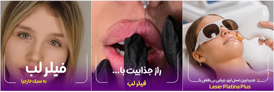 لیزر کرمان در کلینیک ونوس کاملا قابل انجام است