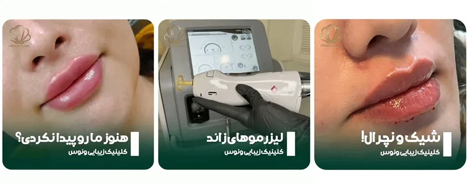 نمونه کار کلینیک ونوس را میتوانید در این تصویر مشاهده بفرمایید.