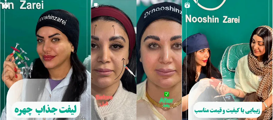 انجام لیزر بوشهر در کلینیک لیزر دکتر زارعی کاملا قابل انجام است