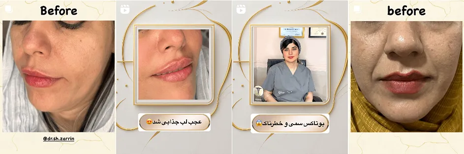 نمونه کار یکی از بهترین کلینیک زیبایی خرم اباد را مشاهده میفرمایید.