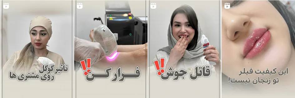 نمونه کار یکی از بهترین کلینیک زیبایی زنجان را مشاهده میفرمایید.