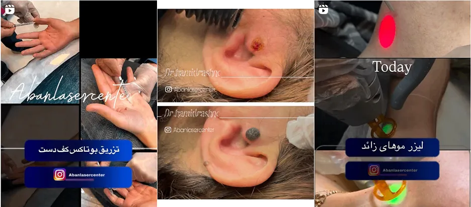 نمونه کار یکی از موفق ترین مراکز لیزر در خرم آباد را مشاهده میفرمایید.