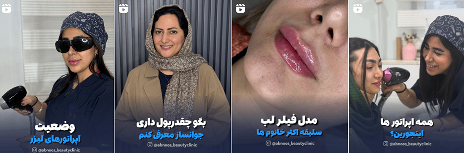 بهترین کلینیک و مرکز پاکسازی پوست در گرگان(فیشیال)+ 1404