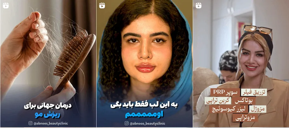 نمونه کار یکی از مدرن ترین مراکز لیزر در گرگان را مشاهده میفرمایید.