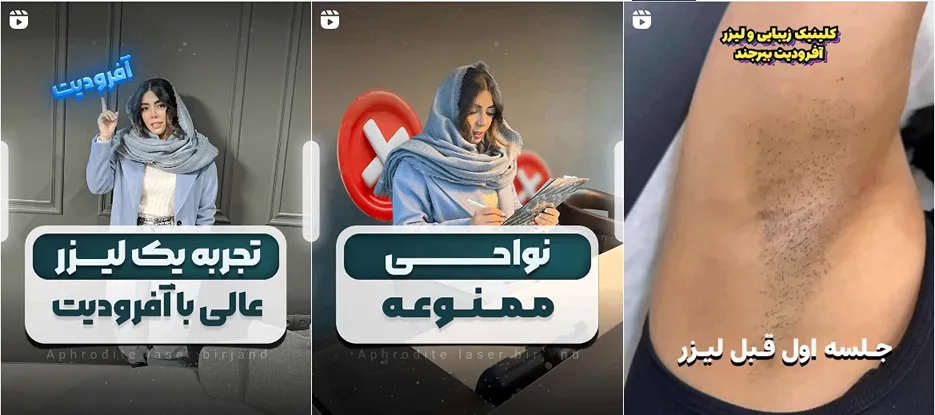 نمونه کار یکی از برترین مراکز لیزر بیرجند را مشاهده میفرمایید.