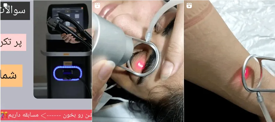 نمونه کار یکی از برترین مرکز لیزر در خرم آباد را مشاهده میفرمایید.