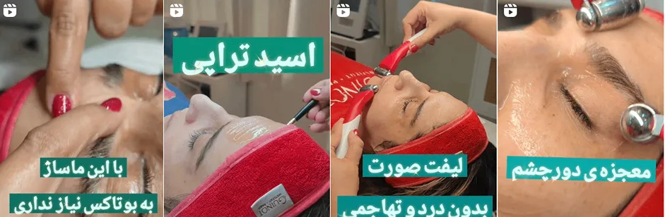 بهترین کلینیک و مرکز پاکسازی پوست در یزد(فیشیال)+ 1404