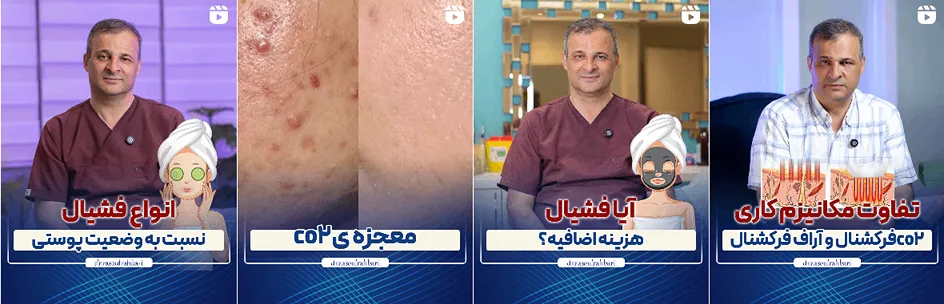 فیشال پوست در تبریز در کلینیک دکتر رسول رهبری انجام میشود