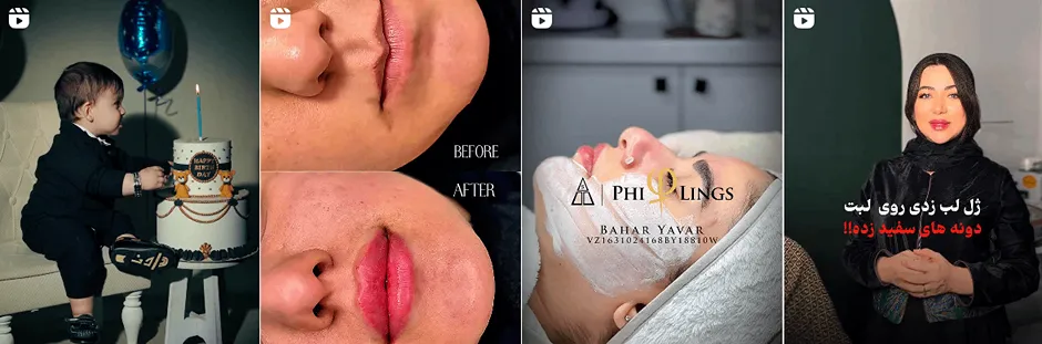 بهترین کلینیک و مرکز پاکسازی پوست در یزد(فیشیال)+ 1404