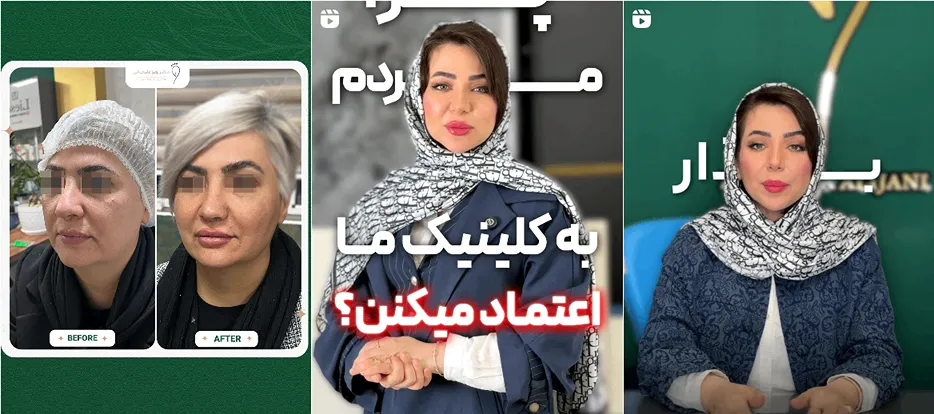 نمونه کار بهترین مرکز لییزر یزد را مشاهده میفرمایید.