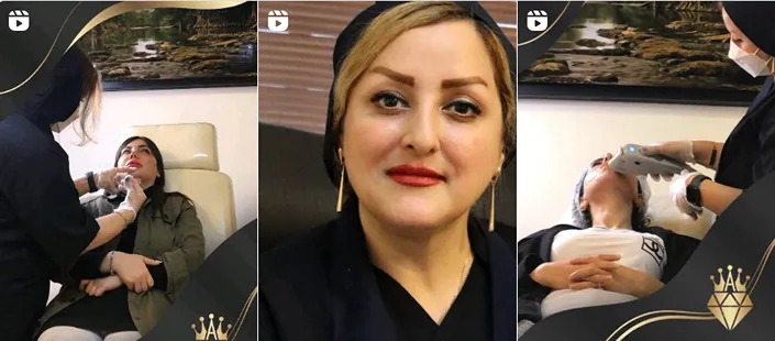 بهترین کلینیک و مرکز پاکسازی پوست در رشت (فیشیال)+ 1404