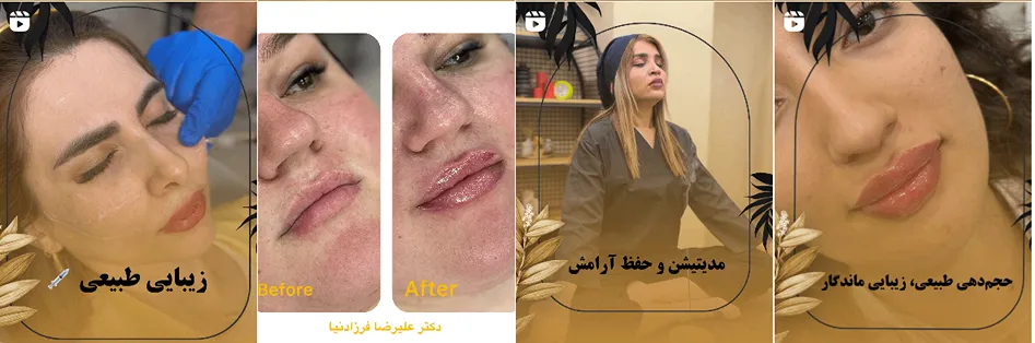 بهترین کلینیک و مرکز پاکسازی پوست در بوشهر(فیشیال)+ 1404