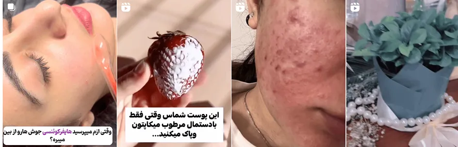 بهترین کلینیک و مرکز پاکسازی پوست در گرگان(فیشیال)+ 1404