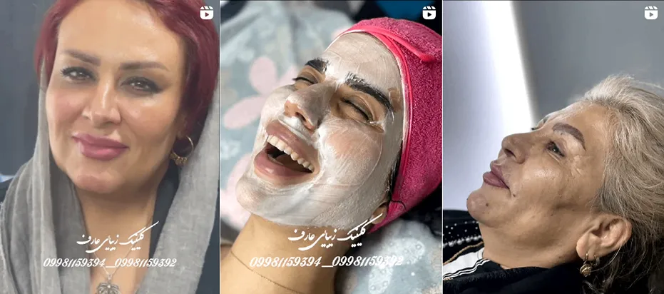 بهترین کلینیک و مرکز پاکسازی پوست در شیراز(فیشیال)+ 1404