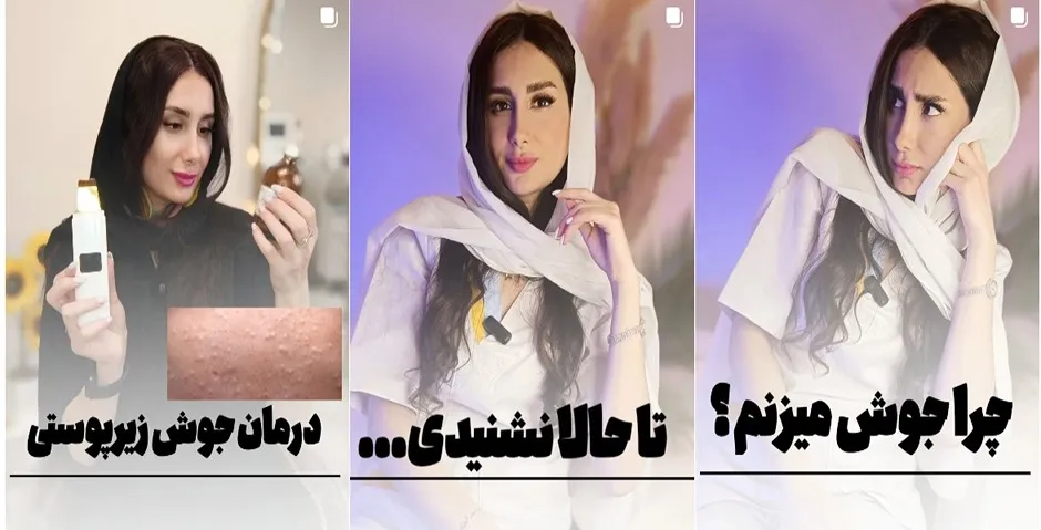 پاکسازی تخصصی پوست در تهران توسط رویا باقریان صورت میپذیرد