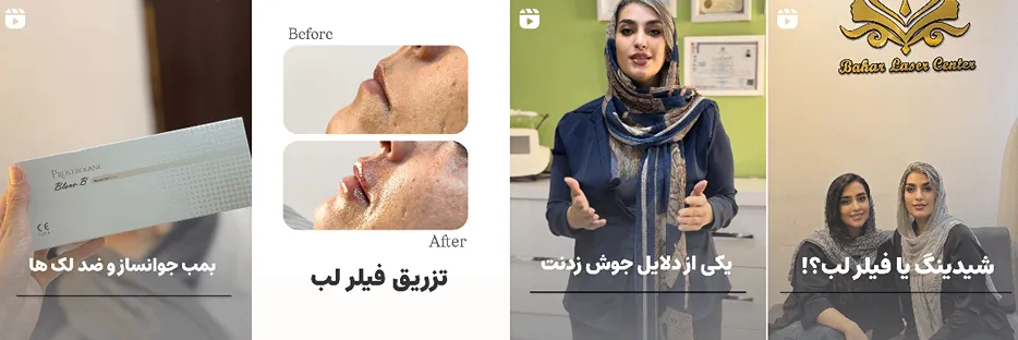 بهترین کلینیک و مرکز پاکسازی پوست در یزد(فیشیال)+ 1404