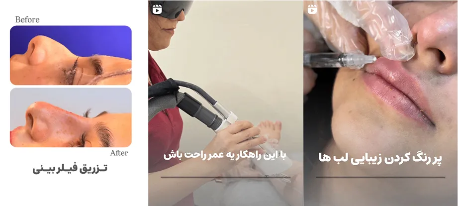 نمونه کار یکی دگر از بهترین مراکز لیزر یزد را مشاهده میفرماییید.