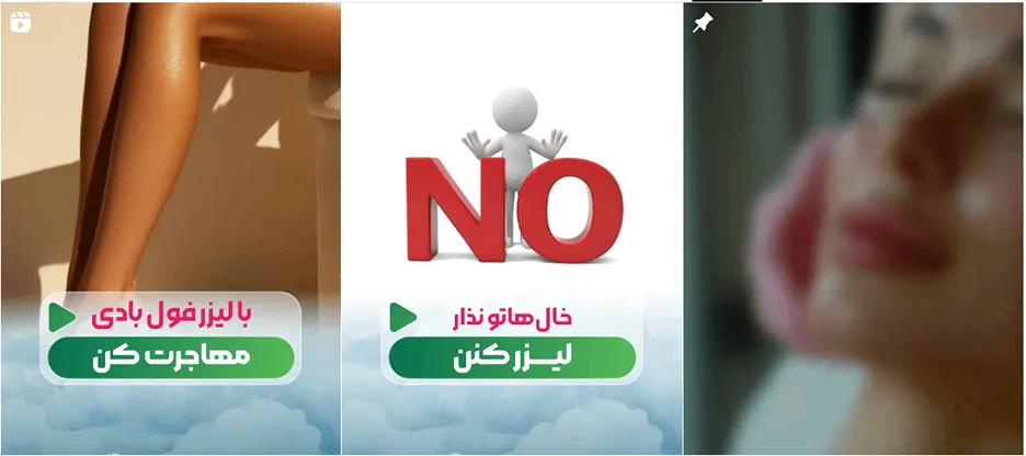 مرکز زیبایی باران قابلیت انجام لیزر در گرگان را برای تمامی مراجعین فراهم کرده است