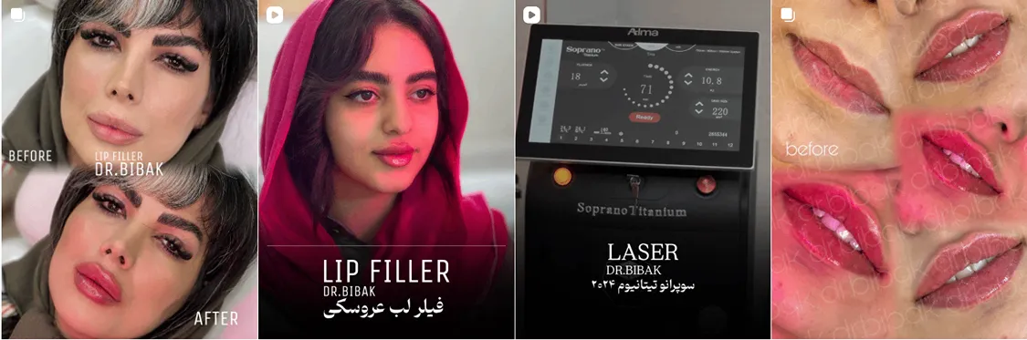 لیزر در بجنورد در کلینیک زیبایی دکتر بی باک کاملا قابل انجام است