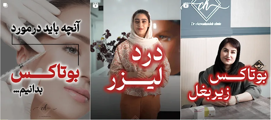 نمونه کار بهترین کلینیک لیزر یزد را مشاهده میفرمایید.