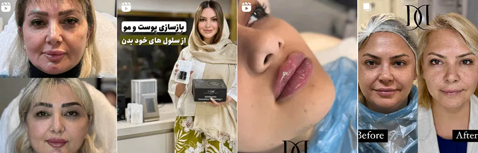 بهترین کلینیک و مرکز پاکسازی پوست در ارومیه(فیشیال)+ 1404