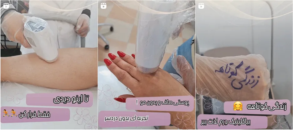 نمونه کار یکی از بهترین مرکز لیزر در گرگان را مشاهده میفرمایید.