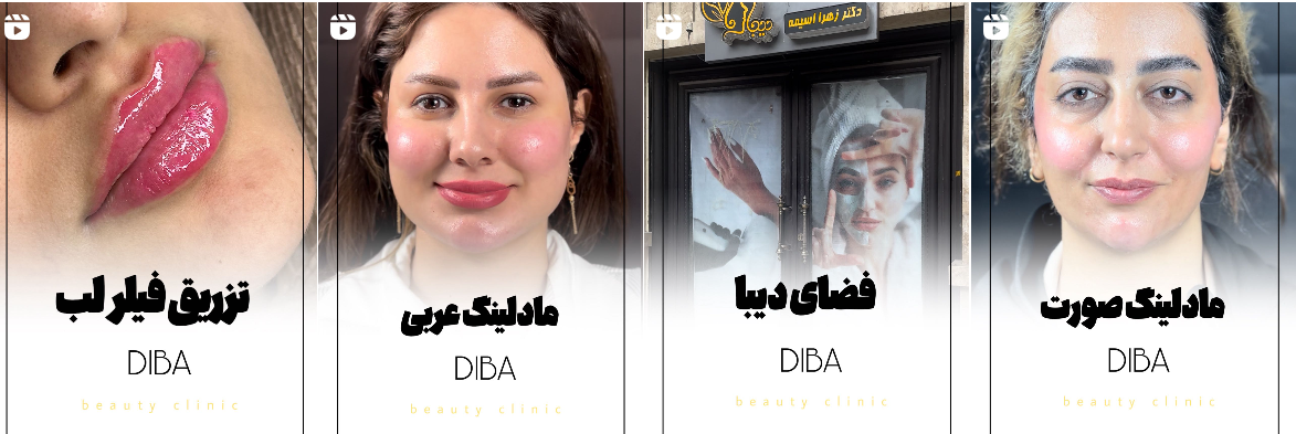 بهترین کلینیک و مرکز پاکسازی پوست در کرمانشاه(فیشیال)+ 1404