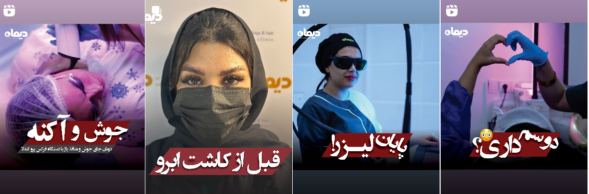 بهترین کلینیک و مرکز پاکسازی پوست در کرمانشاه(فیشیال)+ 1404