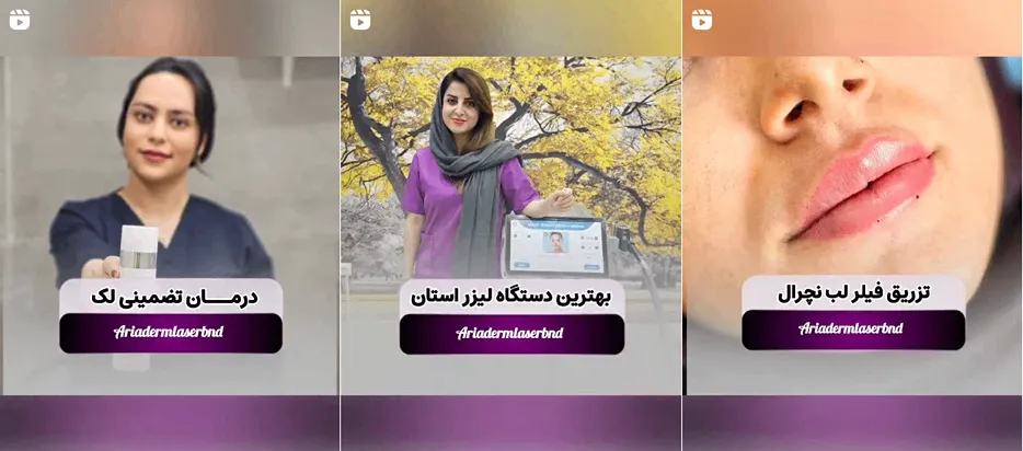 نمونه کار یکی از بهترین مراکز لیزر در بندرعباس را مشاهده میفرمایید.