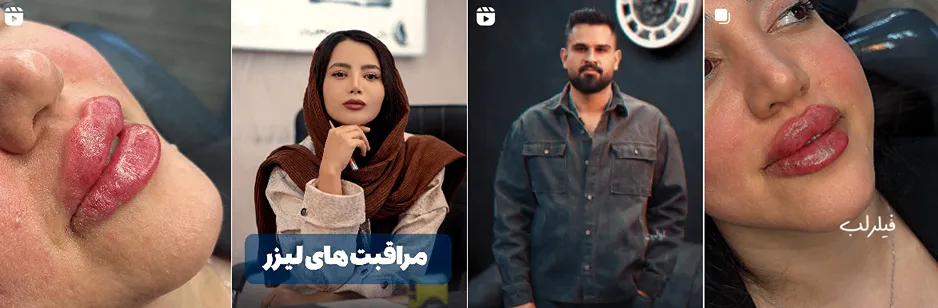 بهترین کلینیک و مرکز پاکسازی پوست در همدان (فیشیال)+ 1404