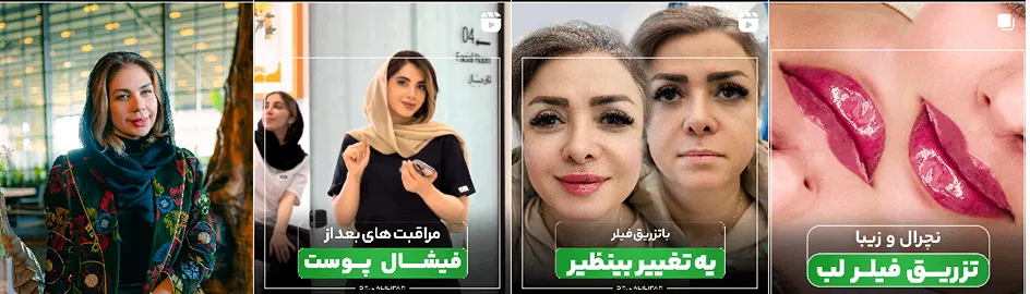 بهترین کلینیک و مرکز پاکسازی پوست در اردبیل(فیشیال)+ 1404