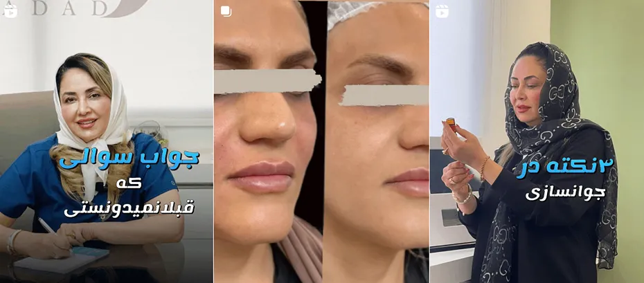 کلینیک دکتر مرجان حداد بهترین کلینیک پاکسازی پوست در اصفهان میباشد.