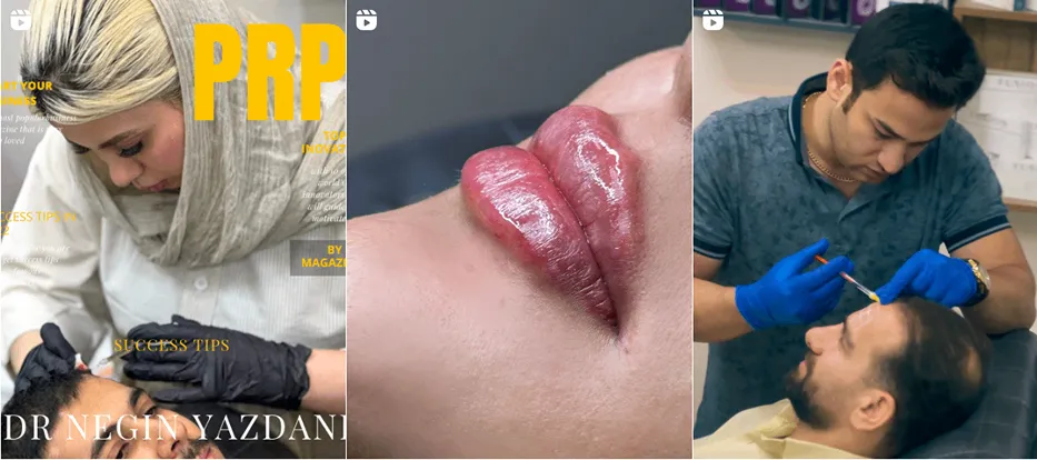 نمونه کار یکی از بهترین کلینیک لیزر بجنورد را مشاهده میفرمایید.