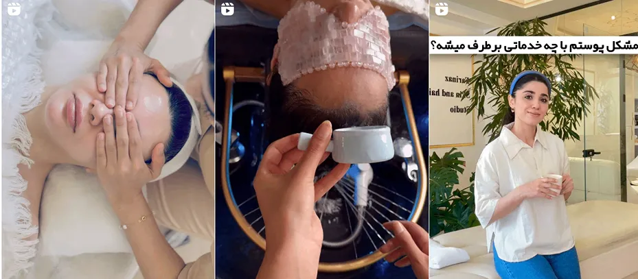 بهترین فیشال پوست توسط فریناز انصاری انجام میشود