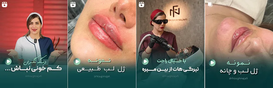 بهترین کلینیک و مرکز پاکسازی پوست در اراک(فیشیال)+ 1404